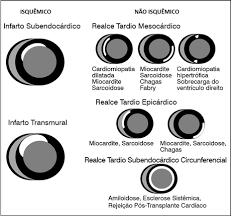 We did not find results for: Http Socesp Org Br Revista Assets Upload Revista 8397164851526395414pdfptquando 20a 20resson C3 82ncia 20magn C3 89tica 20importa 20para 20a 20avalia C3 87 C3 83o 20das 20cardiopatias Revista 20socesp 20v27 20n2 Pdf