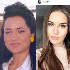 Bir dizi aşkı daha gerçek oldu: Fahriye Evcen In Estetik Oncesi Hali Magazinin Elli Tonu Facebook
