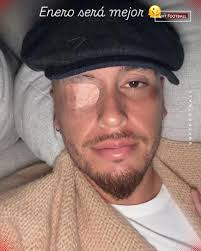 🙏 Wishing Mateo Levy a quick and full recovery 🙏 During Mexico's U‑20  match vs Morocco, Mateo received a hard collision to the head in the 26th  minute and was knocked unconscious,