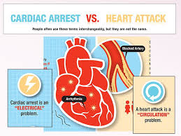 Cardiac arrest is also known as circulatory arrest. Quiz Time A Coronary Artery Disease B Heart Attack C Cardiac Arrest D All Of The Above Q1 What Is Myocardial Infarction Ppt Download