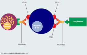 Administering Rituximab Infusion Related Reactions And