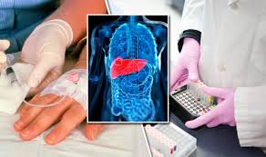 Liver cancer symptoms include jaundice and a lump below the rib cage on your right side. Virus Which Can Cause Cough Could Treat Deadly Liver Cancer And Hepatitis C Express Co Uk