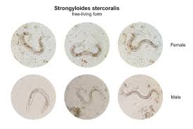 Image result for Strongyloides
