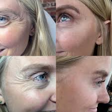 Breana May, FNP-C (@bre_740aesthetics) · Instagram photos and videos