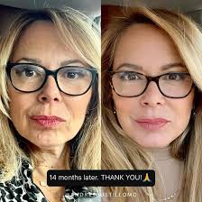 Andres Bustillo, MD, FACS