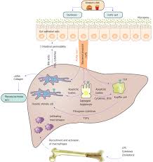 Ahz associates is a proud representative of higher education institutes based in the united kingdom with many branches in all over the world. Macrophages In Metabolic Associated Fatty Liver Disease