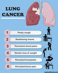 Your lungs are two spongy organs in your chest that take in oxygen when you inhale and release carbon dioxide when you exhale. Symptoms Of Lung Cancer Causes Signs Risk Factors My Health Only