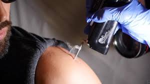 The best 10 laser hair removal in washington, dc. How The Science Behind Laser Hair Removal Works