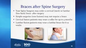 Most patients will be home roughly 2 to 5 days after surgery. You Ve Decided To Have Surgery Now What Neck And Lumbar Brace Demonstration Youtube