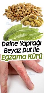 Kuru Dut Ve Defne Yapragi Ile Egzama Tedavisi Beslenme Dogal Saglik Ve Saglikli Olmak