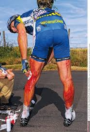 Huzarski and his legs stood in 68th place before sunday's 21st and final stage. Tour De France Legs After Race