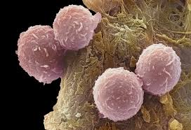 Image result for Chemotherapy