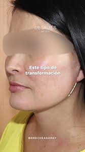 ¡Un cambio que habla por sí solo!...