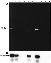 Image result for White 1999 AAV