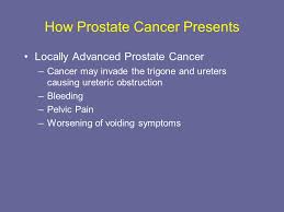 Some men may feel tired, weak or lose weight. Investigation And Management Of Prostate Cancer Ppt Download