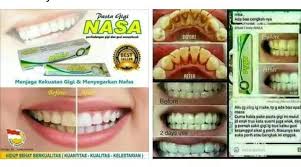 Pasta Gigi Nasa Perontok Karang Gigi Home Facebook