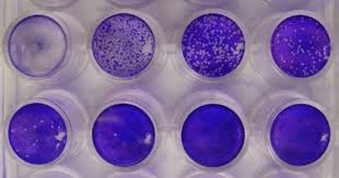 Image result for Neutralization Test