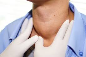 People with head and neck cancer often experience the following symptoms or signs. Are There Early Symptoms For Head And Neck Cancer Chicago Ent