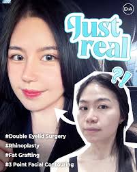 Amazing DA Results!✨ Enhance Your Beauty and Be More Confident!💕 Find your  inner beauty and outer beauty with DA 💖 Visit DA Plastic Surgery &  Dermatology🥰 For more information, DM us or