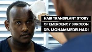 Pre-Op Hair Transplant w/ Dr. Patrick Mwamba
