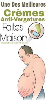 Une Des Meilleures Cremes Anti Vergetures Faites Maison Creme Anti Vergeture Anti Vergeture Vergetures