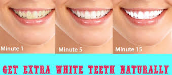 How much does it cost to get laser teeth whitening? Make Your Teeth Crystal White Teeth With These 3 Natural Ways Sudbury Dental