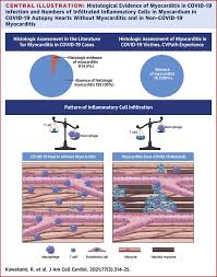 In both cases, the body's immune system is causing inflammation in response to an infection or some other trigger. Pathological Evidence For Sars Cov 2 As A Cause Of Myocarditis Jacc Review Topic Of The Week Sciencedirect