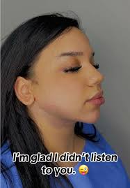 Double chin liposuction✅ Buccal fat remover✅ Chin filler ✅ BEST Decision  Ever‼️💞  ##chinlipo##chinliposuction##chinlipocheck##chinliporecovery##chinlipoupdate##doublechinlipo##doublechin##fyp##fypp##fy...