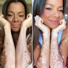 😭 Brings me to tears to wake up everyday more and more healed