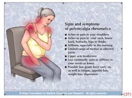 Image result for Polymyalgia Rheumatica