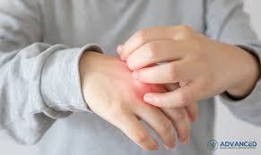 Image result for Hand Infection