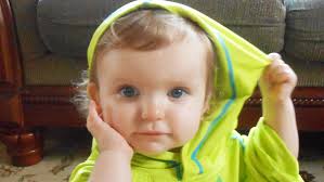 The accessory structures, such as the eyelids or tear glands. Born With Melanoma Toddler Thought To Be Among Youngest Cancer Patients