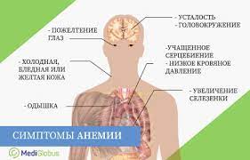 Анемия при других хронических болезнях. Lechenie Aplasticheskoj Anemii V Ispanii Mediglobus