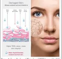 The Study of Sodium Lauryl Sulfate (SLS) Toxicity