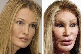 Once upon a time, in the late 70's there was a beautiful women named jocelyn. 10 Celebs Who Ruined Their Faces Through Plastic Surgery Ewmoda