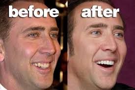 The process involves shaping the gums via a. Top Celebrities Who Received A Hollywood Smile Elite Care Dental