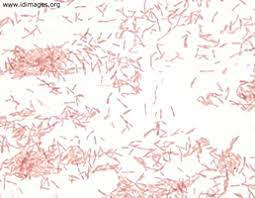 Principle the gram stain is used to classify bacteria on the basis of their forms, sizes, cellular morphologies, and gram reactions; Legionella Images Infectious Disease Images Emicrobes Digital Library Atlas