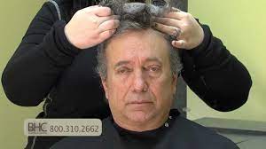 We did not find results for: Non Surgical Hair Replacement Revealed Youtube