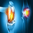 Joint Replacement Doctor in Agra product image