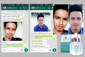 Cara menghilangkan bekas jerawat secara alami. Azanis Scar Serum From Pakistan Aleesyashop Com