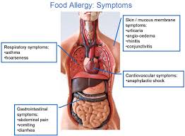 Approximately 50 million americans are affected by some form of allergy. Mechanisms Ucfa Utrecht Center For Food Allergy
