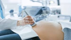 Endometriosis adalah radang yang terkait dengan hormon estrogen, berupa. Ciri Ciri Hamil Muda Pada Perut Yang Sering Terjadi Honestdocs