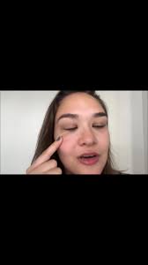 Freckles are weird #fyp