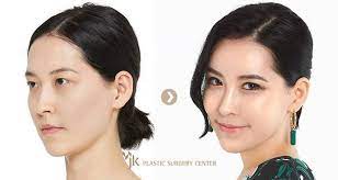 Korea's first and only plastic surgery clinic designated as a good medical institution to attract foreign patients by the korean government. Here S Why 1 In 3 South Korean Women Say They Ve Had Plastic Surgery