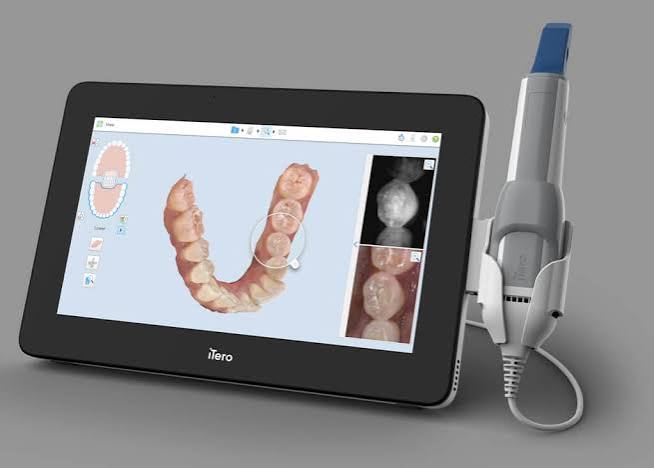 Digital Scanning with Primescan at North Kamloops Dental