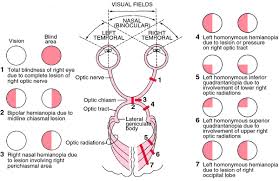 Hemianopia | definition of hemianopia by Medical dictionary
