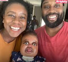 FATHER ADORES DAUGHTER WITH RARE CONDITION: “BABY YOU'RE A FIGHTER”  🥺🥺👏🏾👏🏾🙏🏾🙌🏾 Caliyah Johnson, now 13 months, was born with Pfeiffer  syndrome but continues to crush milestones. Her parents, Rome and Falesha  Johnson,