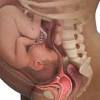 The amount of breast milk babies need varies based on their age. 1