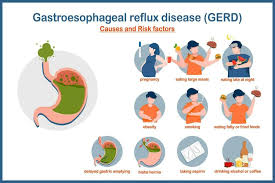 Image result for Pediatric Reflux