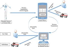 Design and implementation of intelligent mobile phone detector. Survey Smartphone Based Assessment Of Cardiovascular Diseases Using Ecg And Ppg Analysis Bmc Medical Informatics And Decision Making Full Text